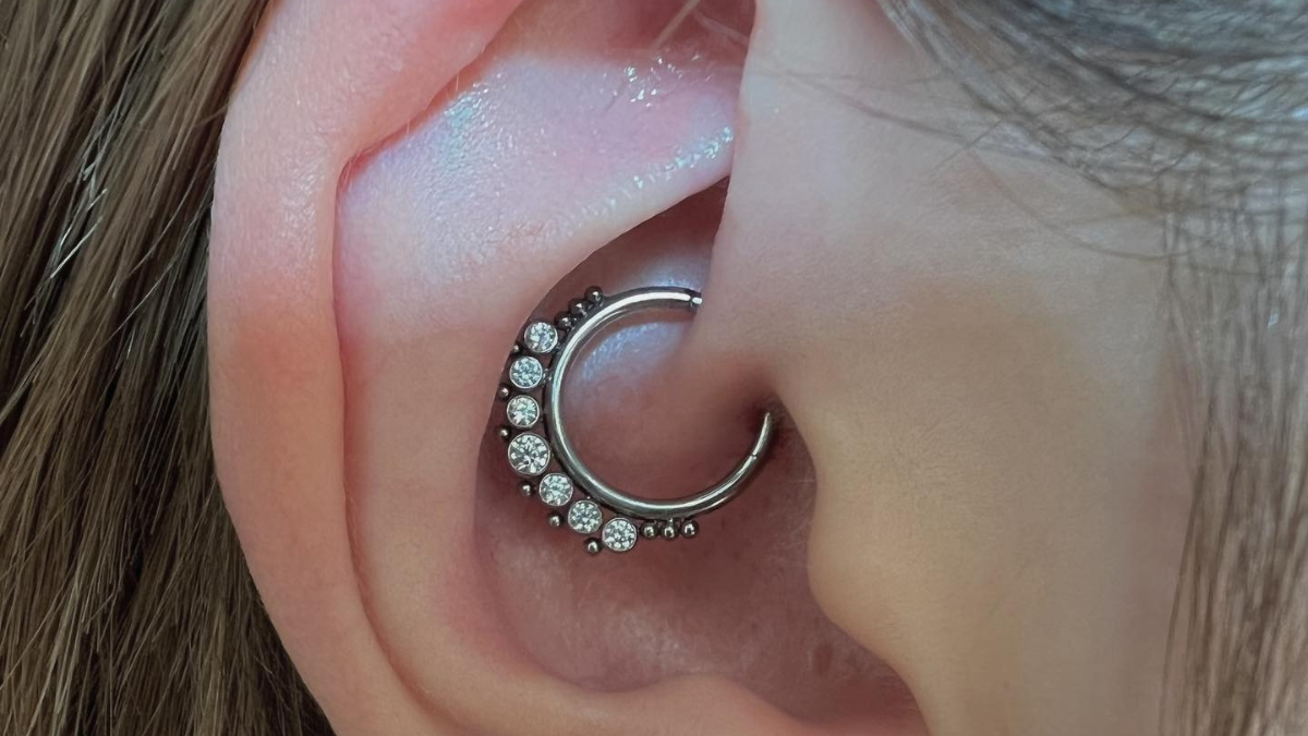  A healed daith piercing with a clicker ring, showing its position in the inner ear fold