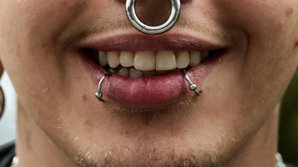 A healed pair of snake bite piercings, one either side of the lower lip